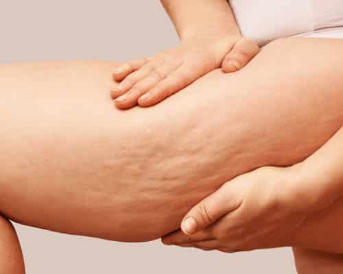 Natural skin texture on an upper thigh before a Glasgow consultation