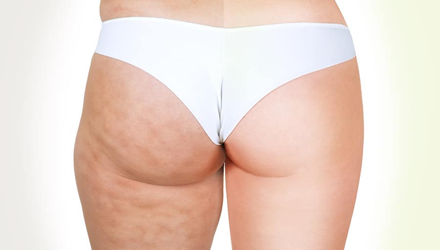 Example photographs used to discuss skin texture rather than promise a result