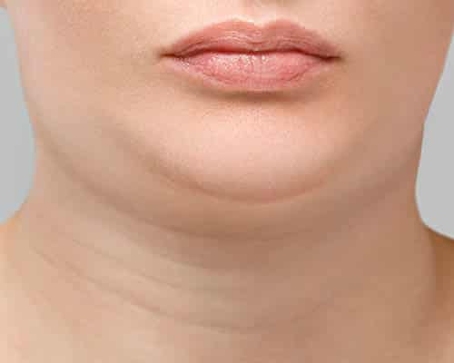 Compact cooling applicator positioned beneath a client's chin