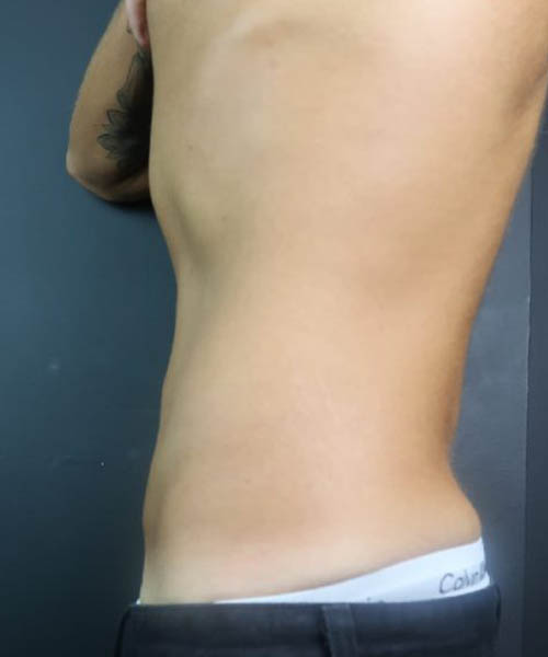 Abdominal profile after that client’s review period