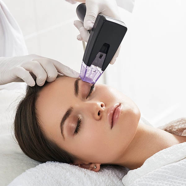 Morpheus8 tip positioned over cleansed skin before an RF pulse