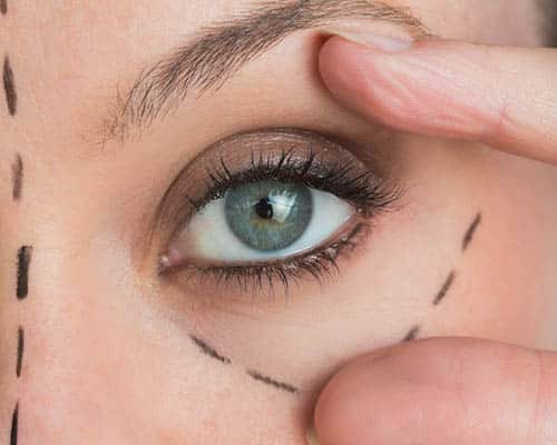 Face and neck areas discussed for radiofrequency in Glasgow
