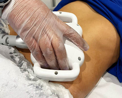 Body-contouring device applied to a marked abdominal area