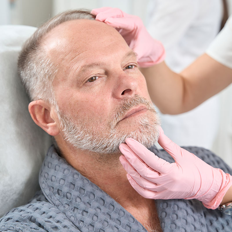 Radiofrequency facial treatment being performed on a man's jawline