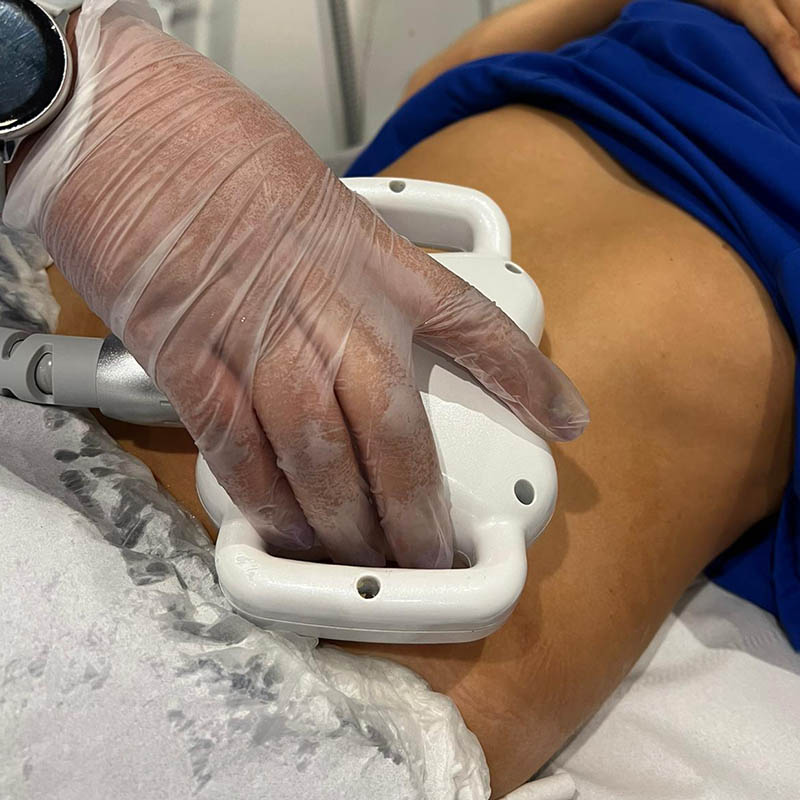 Ultrasound cavitation handpiece moved across a gel-covered abdominal area in Glasgow